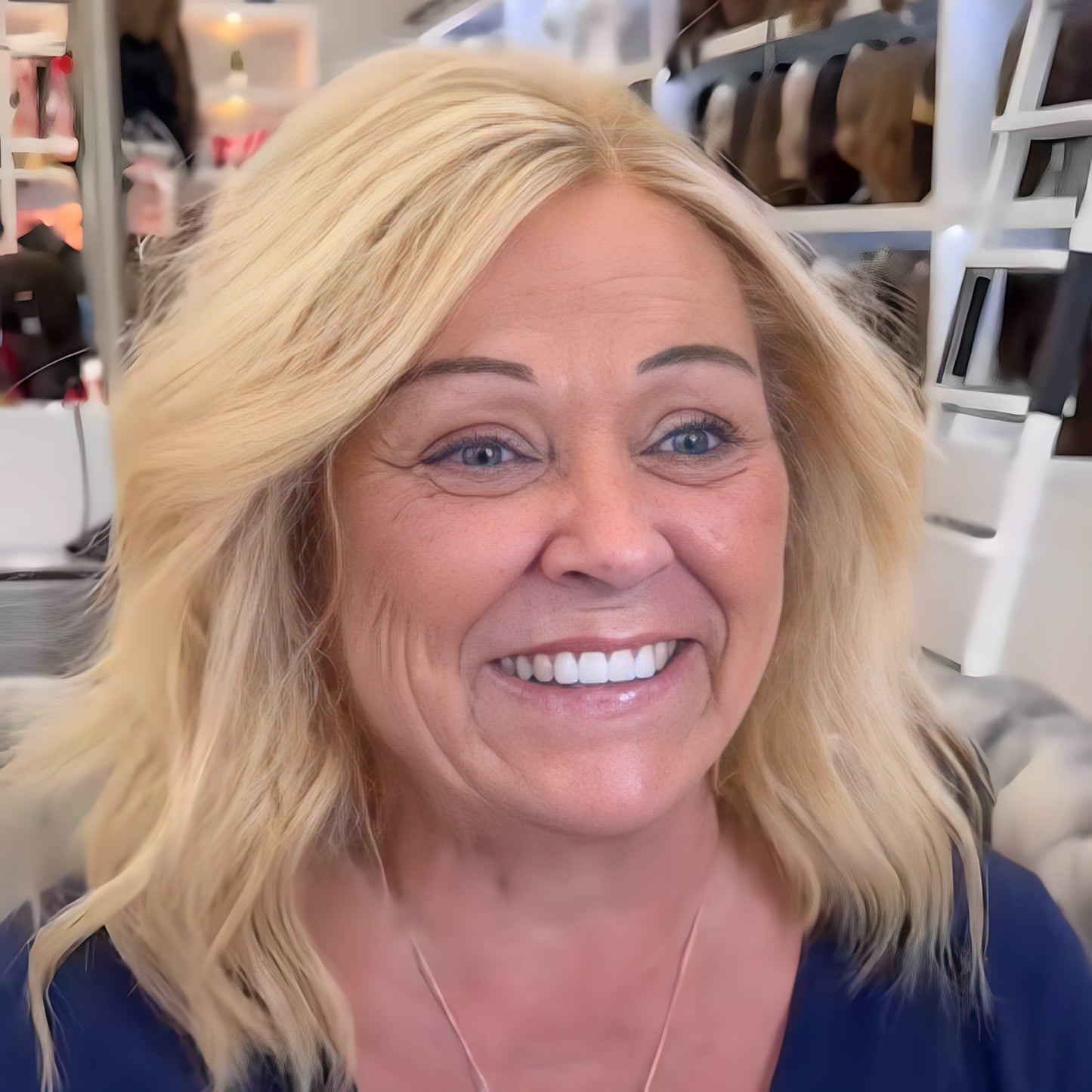 ✨ Receding Hairline? ✨ Fix It Naturally. ✨ Receding Hairline Band